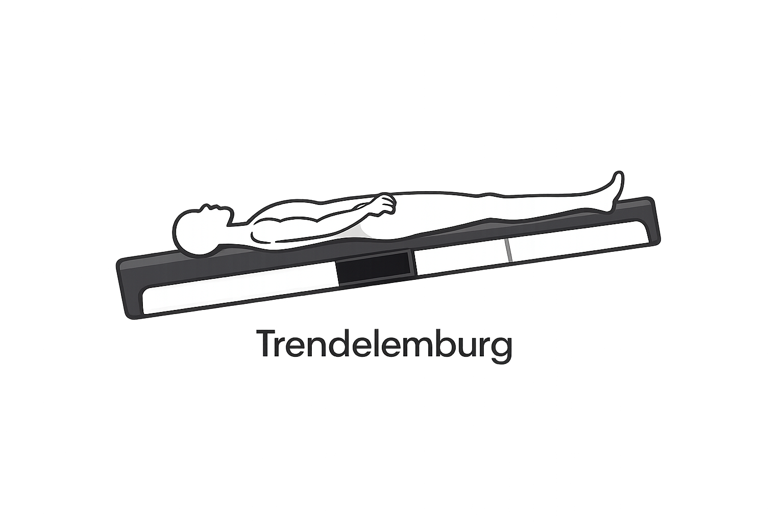 Trendelemburg